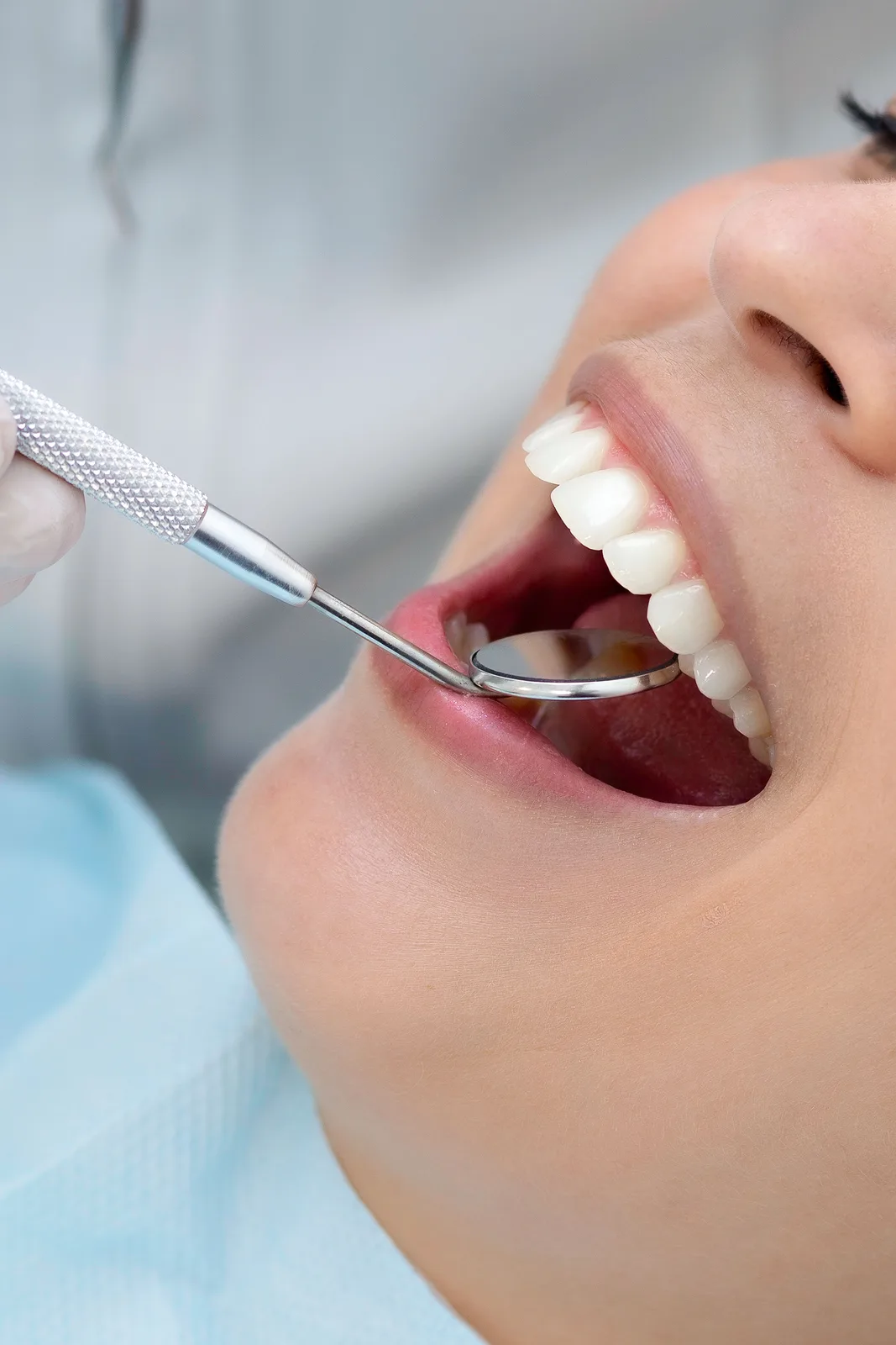 Checking restoration margins with a dental mirror, shown while covering Implant Procedures in Winnipeg