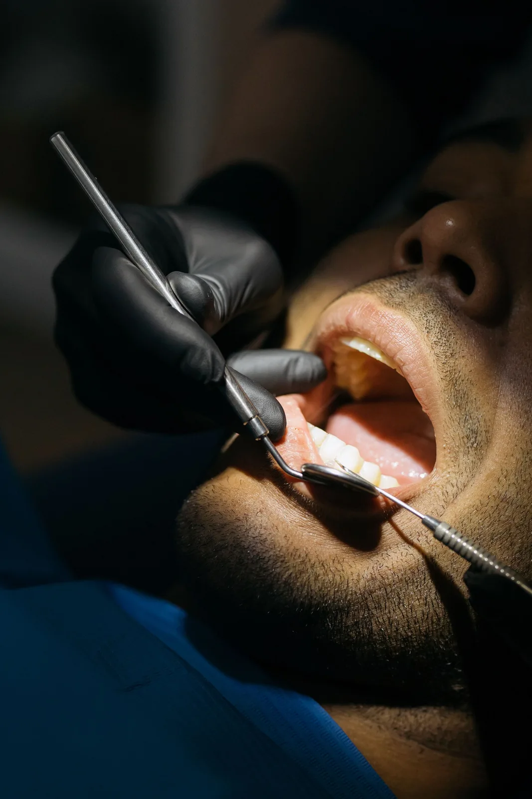 Close-up of a dental examination, referred to in the Dental Implants section for Winnipeg