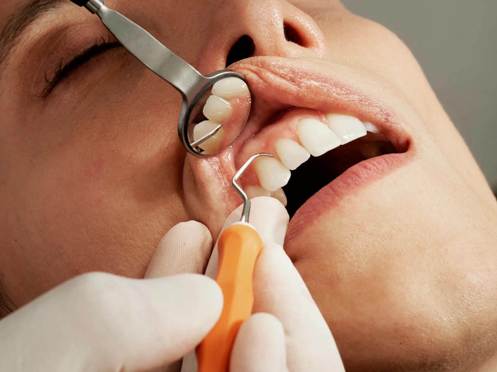 Dental examination with mirror and probe at a consultation in Winnipeg