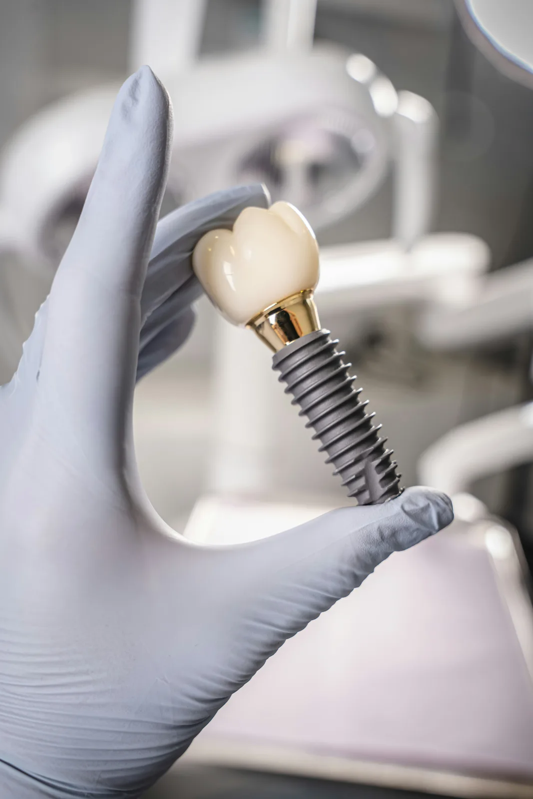 Dental implant fixture, abutment and crown, referred to in the dental implant treatment section for Winnipeg