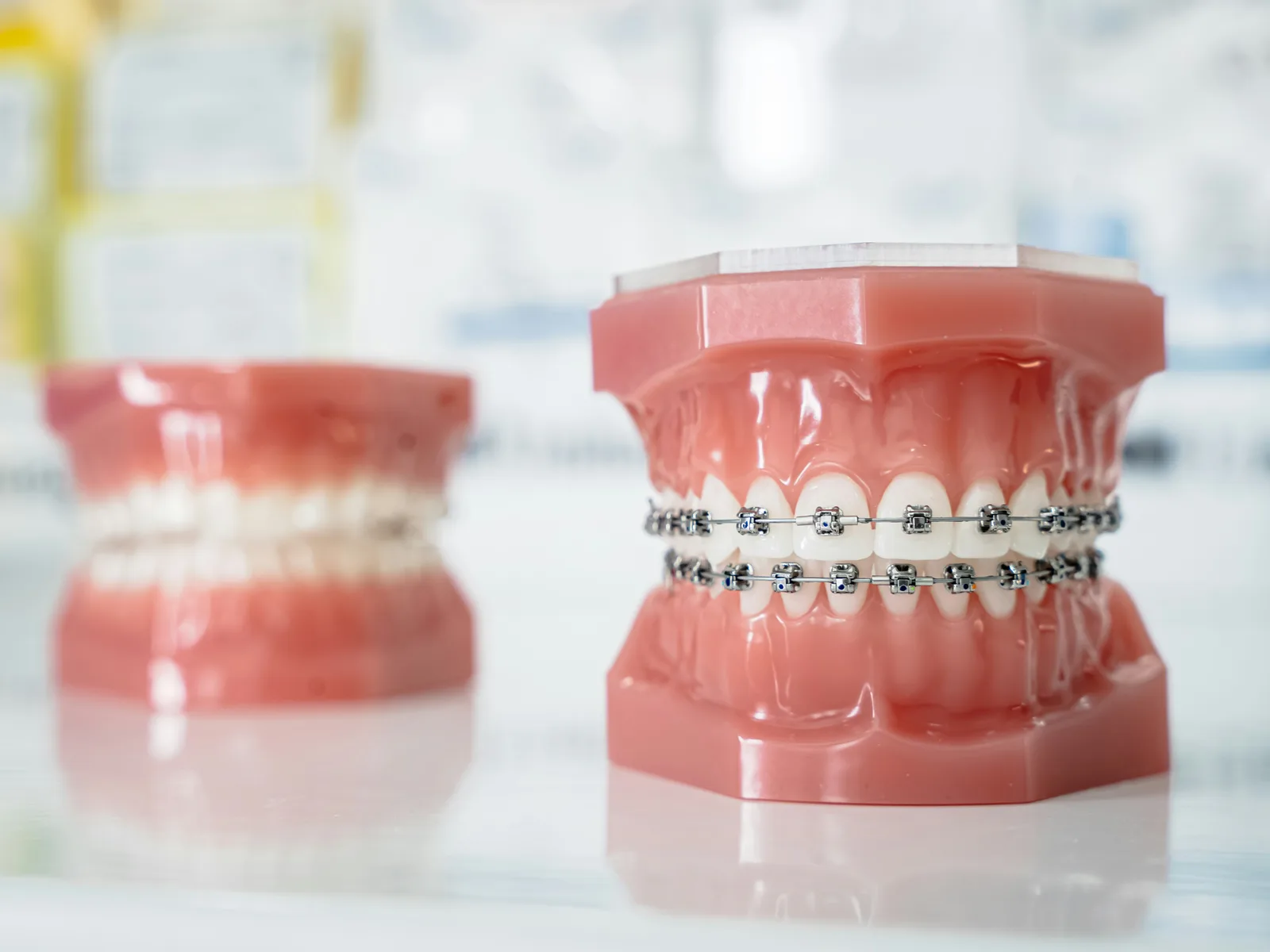 Dental study models at the practice, alongside the Same Day Implants explanation in Winnipeg