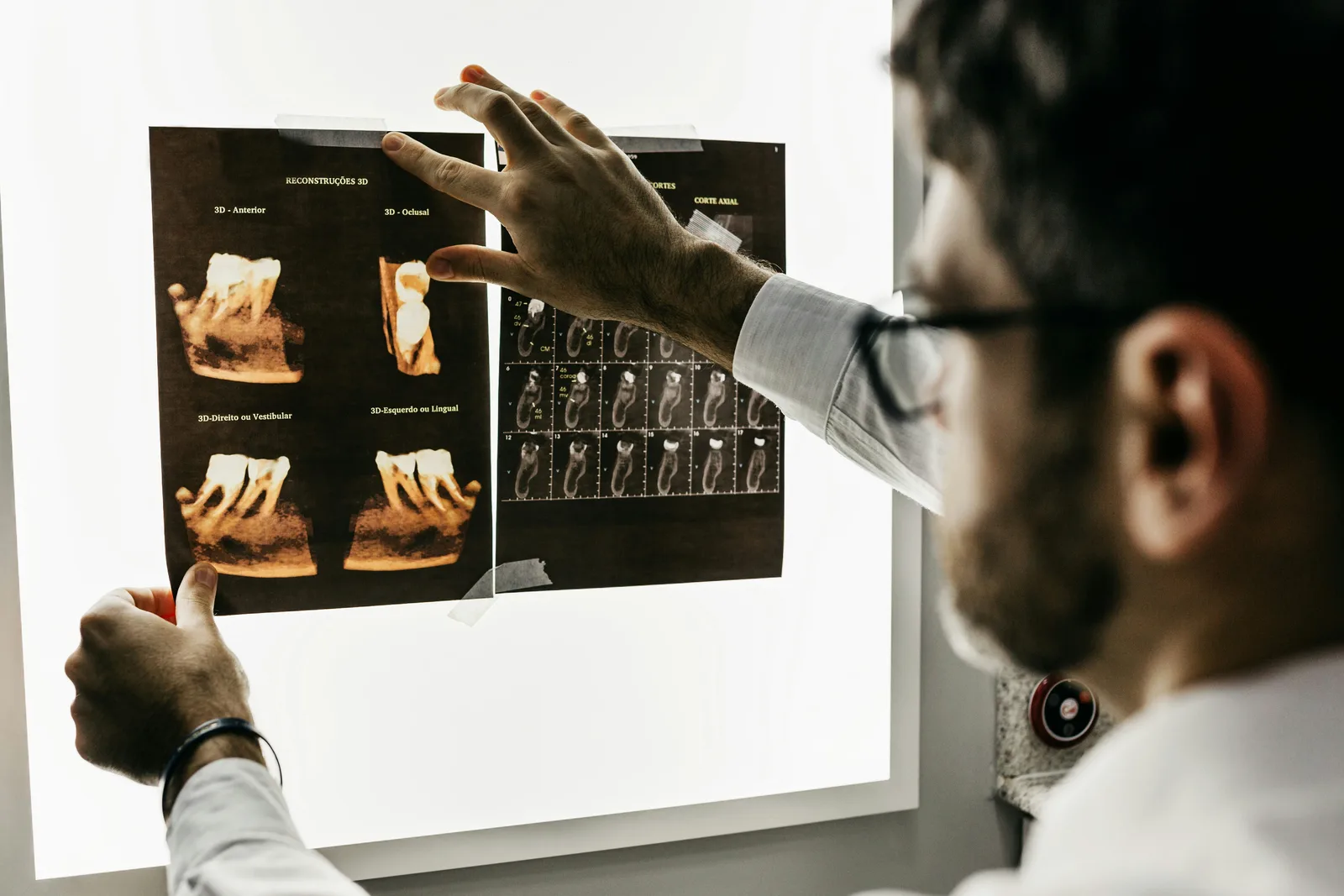 Dentist reviewing a CBCT scan before implant surgery, alongside the dental implant treatment explanation in Winnipeg