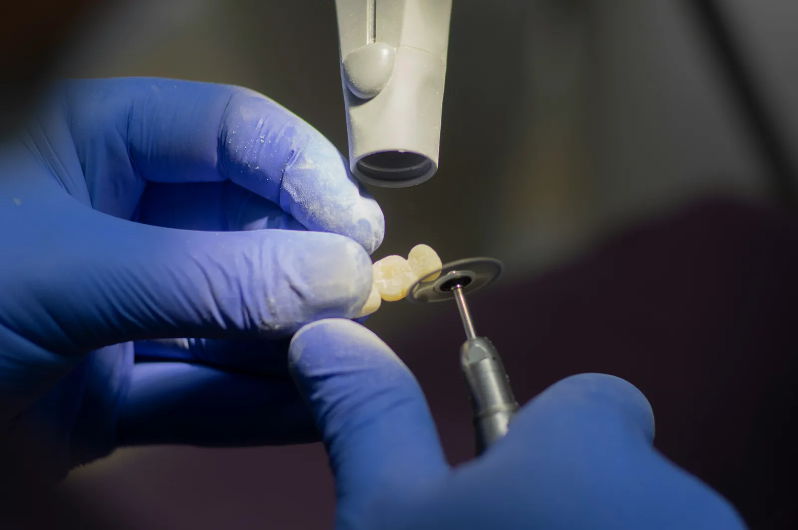 Technician finishing an implant crown in the laboratory, for multiple tooth implants in Winnipeg