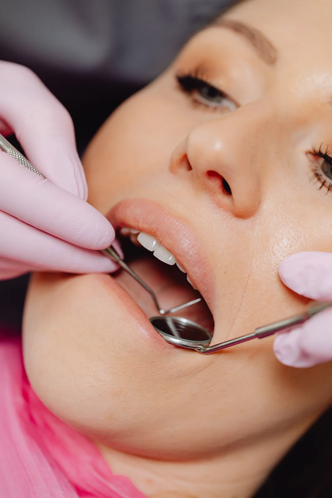 Mirror and probe exam of the lower arch, alongside the All-on-4 Implants explanation in Winnipeg