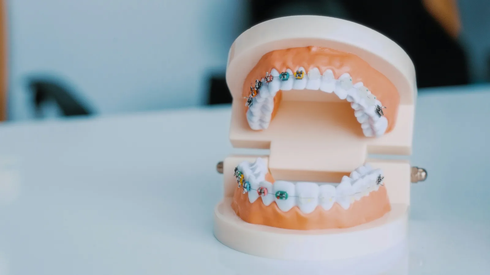 Dental model of the upper and lower arch, alongside the Implant Crown explanation in Winnipeg