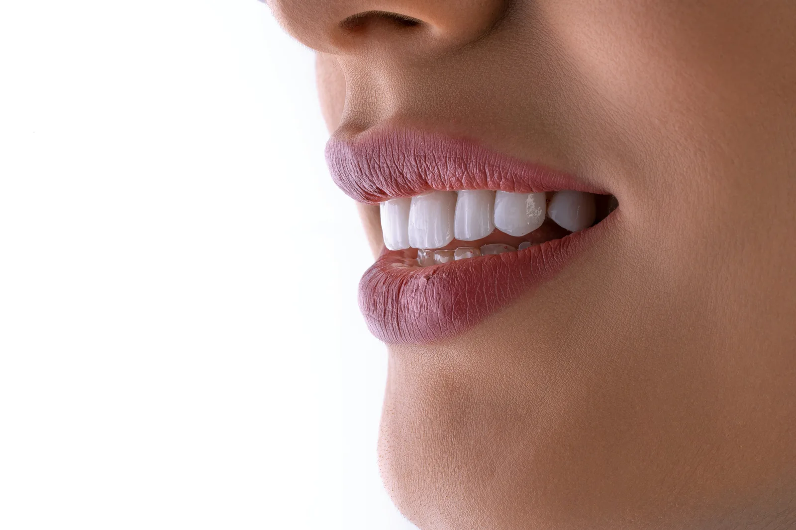 Patient profile smile after implant restoration, referred to in the Same Day Implants section for Winnipeg