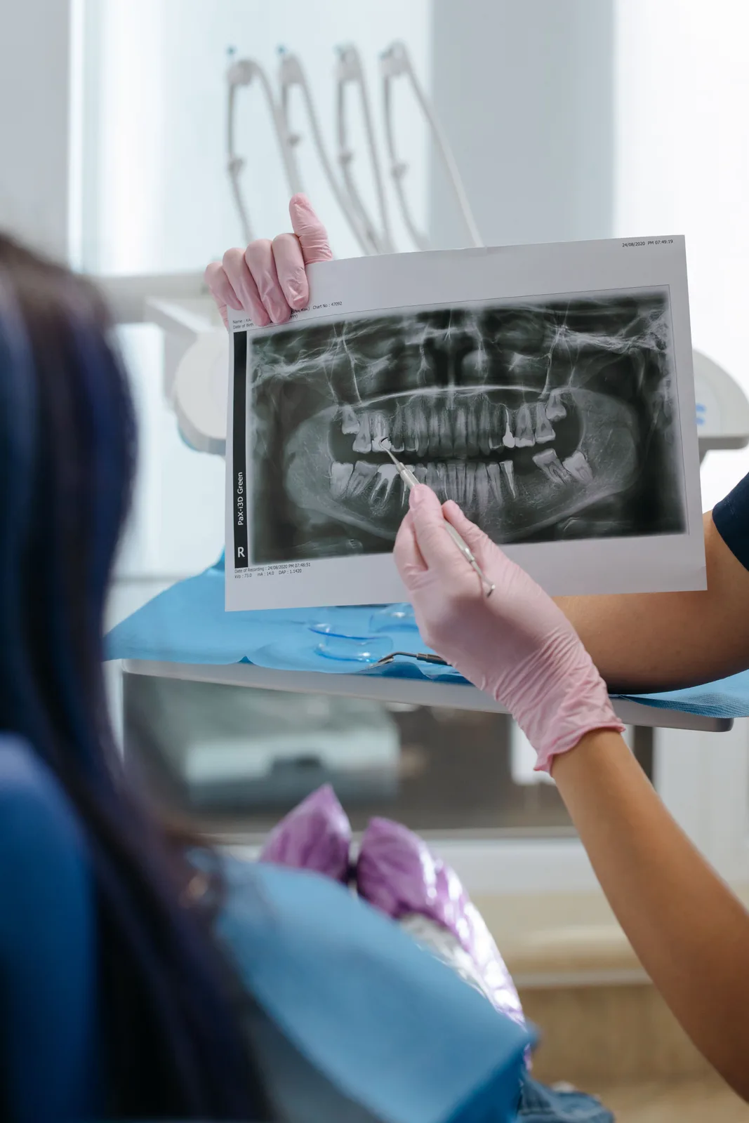 Reviewing a panoramic X-ray with a patient, alongside the Socket Preservation explanation in Winnipeg
