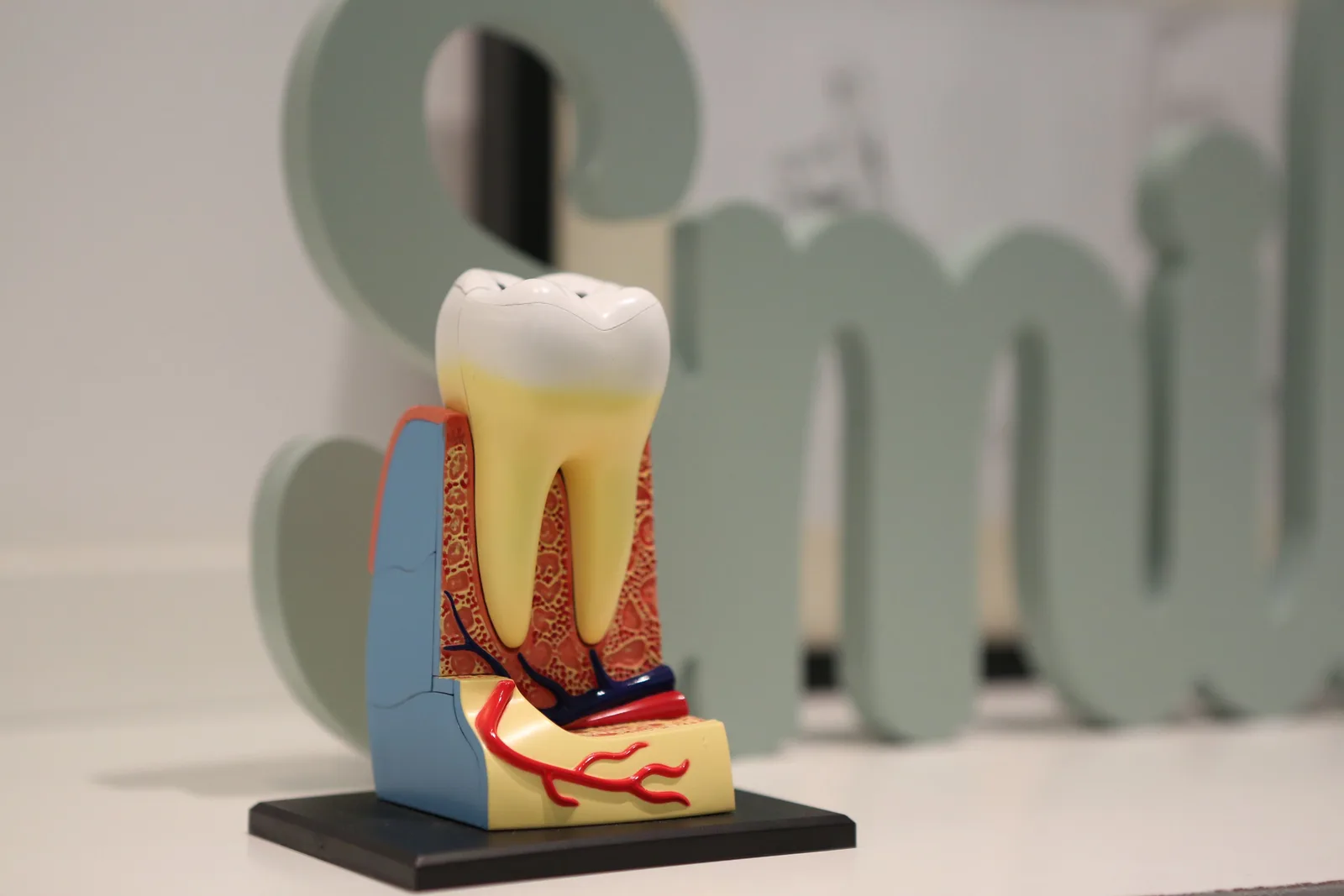 Tooth anatomy model showing the root below the gum, shown while covering Implant Cost in Winnipeg