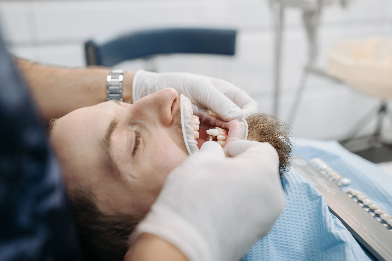 Trying in the shade for an implant crown, alongside the All-on-6 Implants explanation in Winnipeg