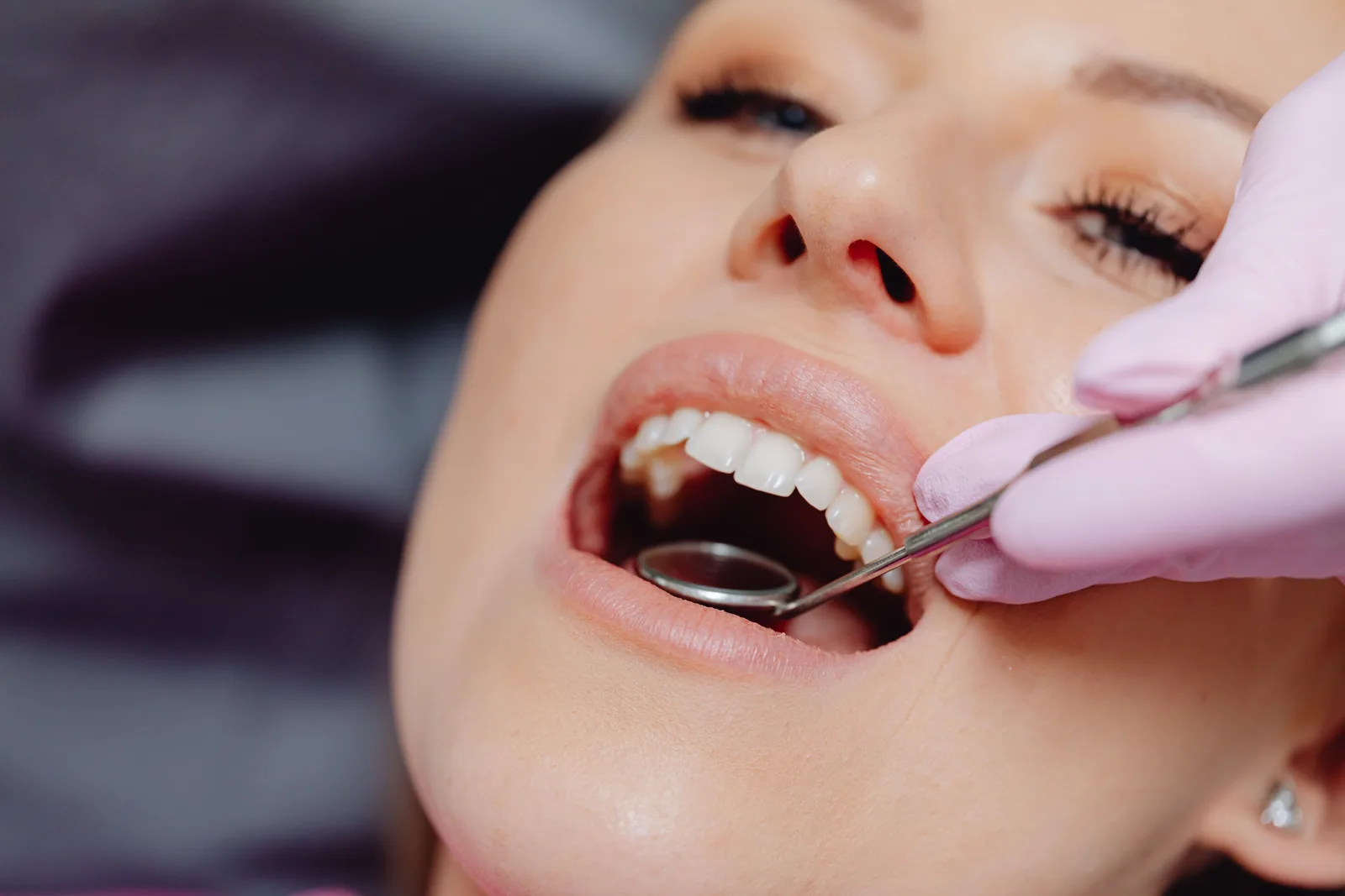 Upper arch exam with mirror and probe, shown while covering All-on-4 Implants in Winnipeg